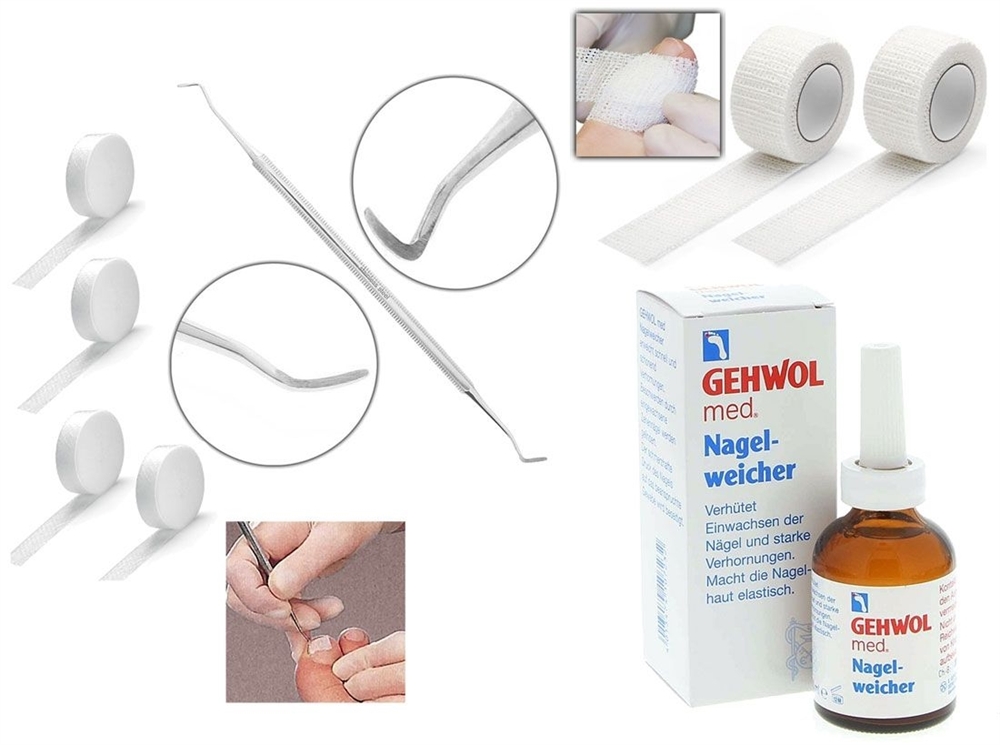 4x Tamponade Kosmetex 2-fach Eckenheber zum Einlegen, Gehwohl Nagelweicher 50 ml (groß) 2x Zehenbinde 2.5 cm elastisch Set 8
